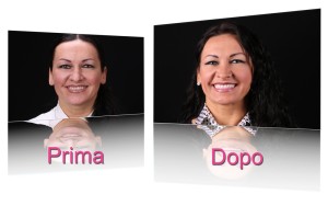 faccette dentali ceramica